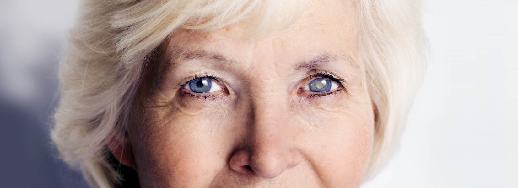 Cataract Surgery in Menomonie